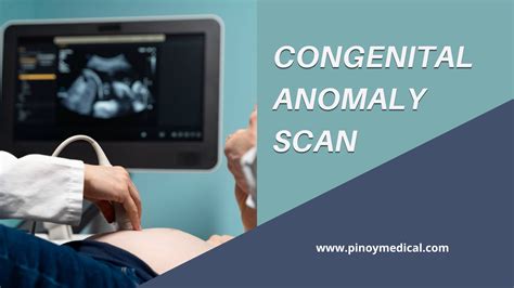 congenital anomaly scan price manila|Congenital Anomaly Scan Price in the Philippines.